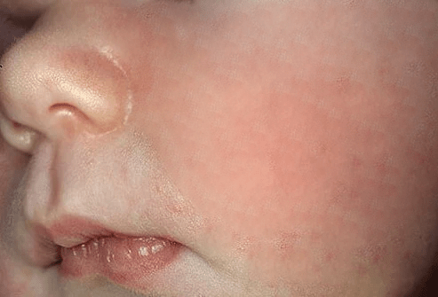 Hình ảnh này chưa có thuộc tính alt; tên tệp của nó là untitled-2.png